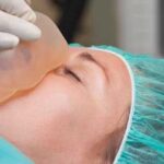 Texas Negligent Intubation Lawyer
